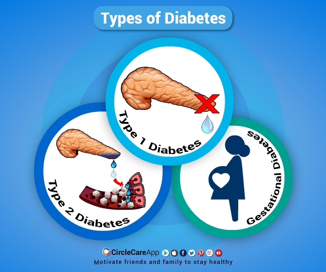 How Many Different Types Of Diabetes Are There CircleCare