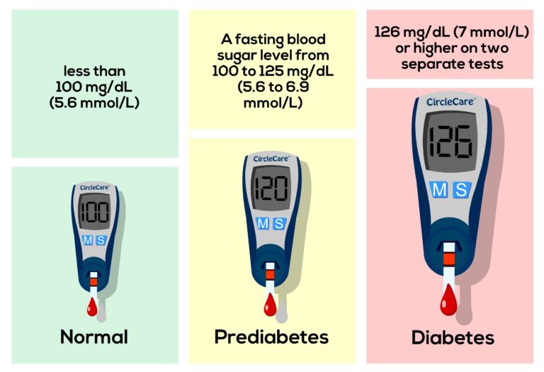 Diagnosis of Diabetes - Blood Sugar Test - Random Plasma Glucose Test 