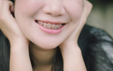 How Invisalign Can Benefit you in Comparison to Other Treatments?